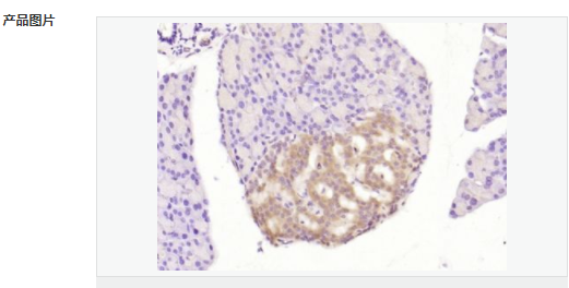 6063d1be2f97b.png image.png