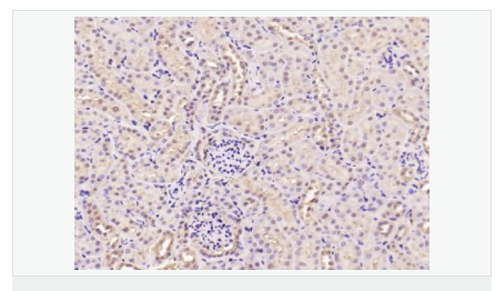 60667948844be.png image.png