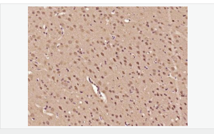 606bcc5a66a10.png image.png