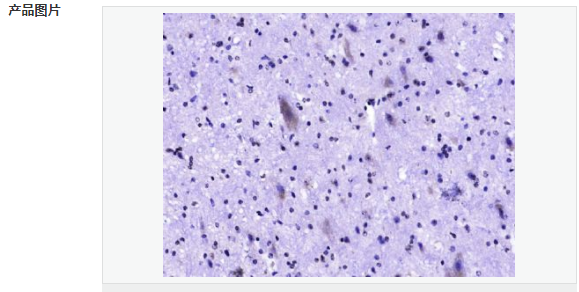 60766605d2de2.png image.png