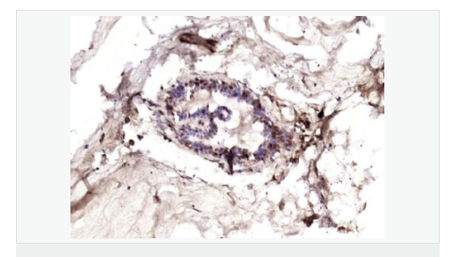 6078f0fa11830.png image.png